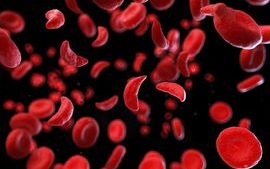 sickle-cell-blood-cells.jpg