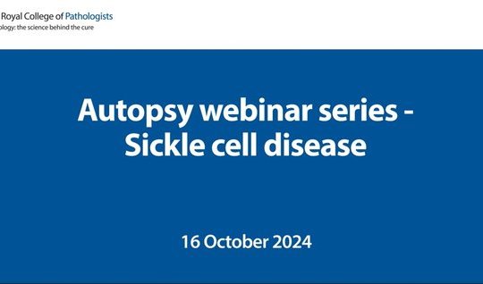 Autopsy webinar series – Sickle cell disease