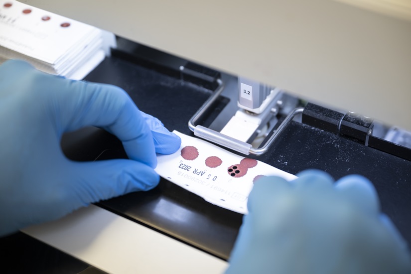 Photograph of tests at newborn screening unit 