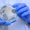 Image of RCPath publishes response to government's 5-year action plan to tackle antimicrobial resistance