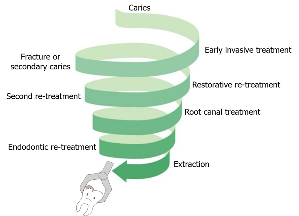 Illustration of the caries treatment spiral from early invasive treatment, secondary caries, re-treatment, root canal, endodontic re-treatment to extraction.