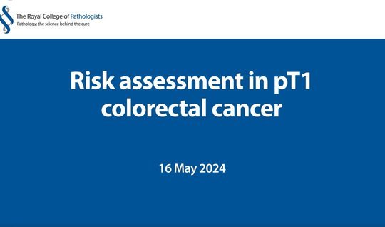 Risk assessment in pT1 colorectal cancer – webinar