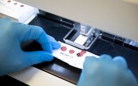 Heel-prick spot testing punch machine in the neonatal laboratory