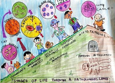 Runner Up: 'The Stages of life through a Pathologist’s lens' by Yusuf Asad Haroon