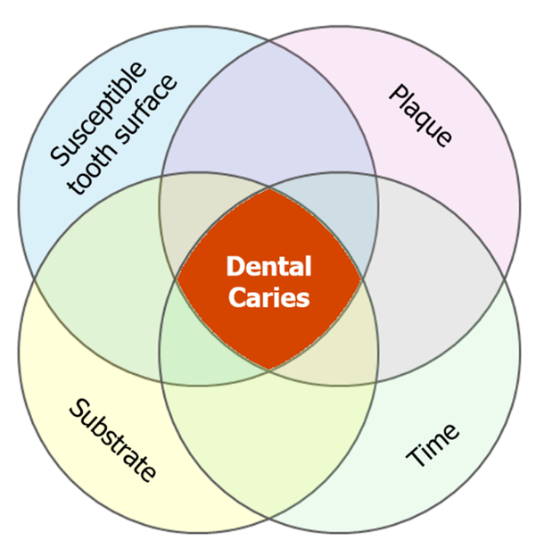 Venn diagram of overlapping dental caries causes: susceptible tooth surface, plaque, substrate, time.