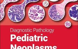 Paediatric neoplasms.jpg