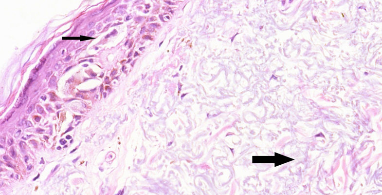 Dermatopathology